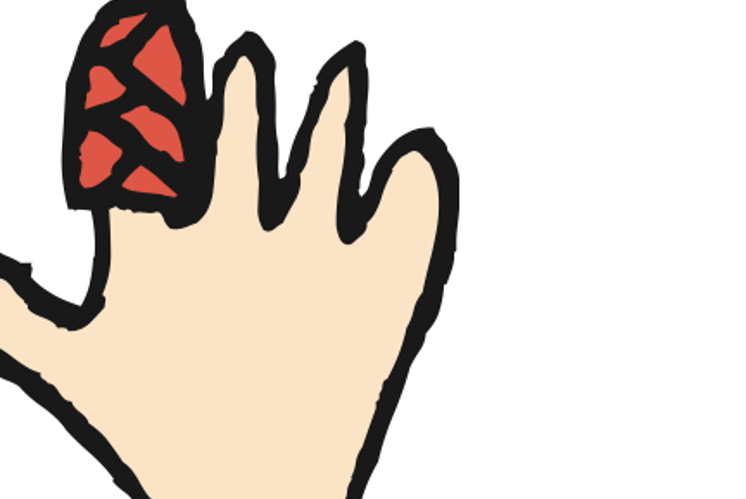Bastle Deinen Gipsfinger